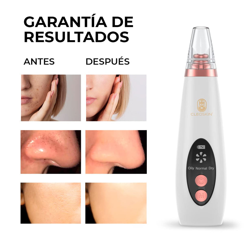 CLEOSKIN Espátula Peeling ultrasónica y turbo removedor de espinillas y puntos negros, exfolia la piel. elimina el sebo facial, máquina de limpieza profunda para acné, comedones, granos. Cuidado de la piel, skincare.