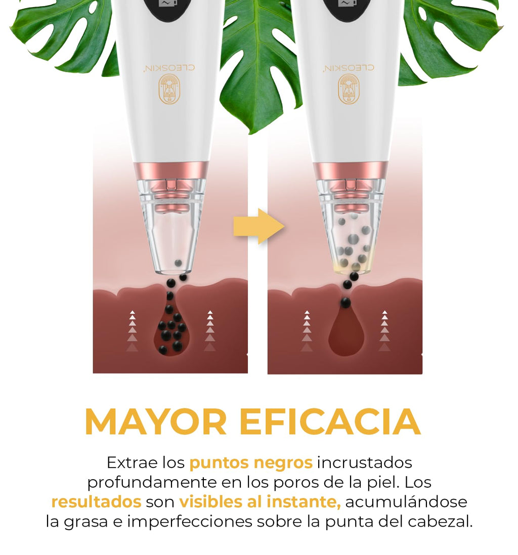 CLEOSKIN Espátula Peeling ultrasónica y turbo removedor de espinillas y puntos negros, exfolia la piel. elimina el sebo facial, máquina de limpieza profunda para acné, comedones, granos. Cuidado de la piel, skincare.