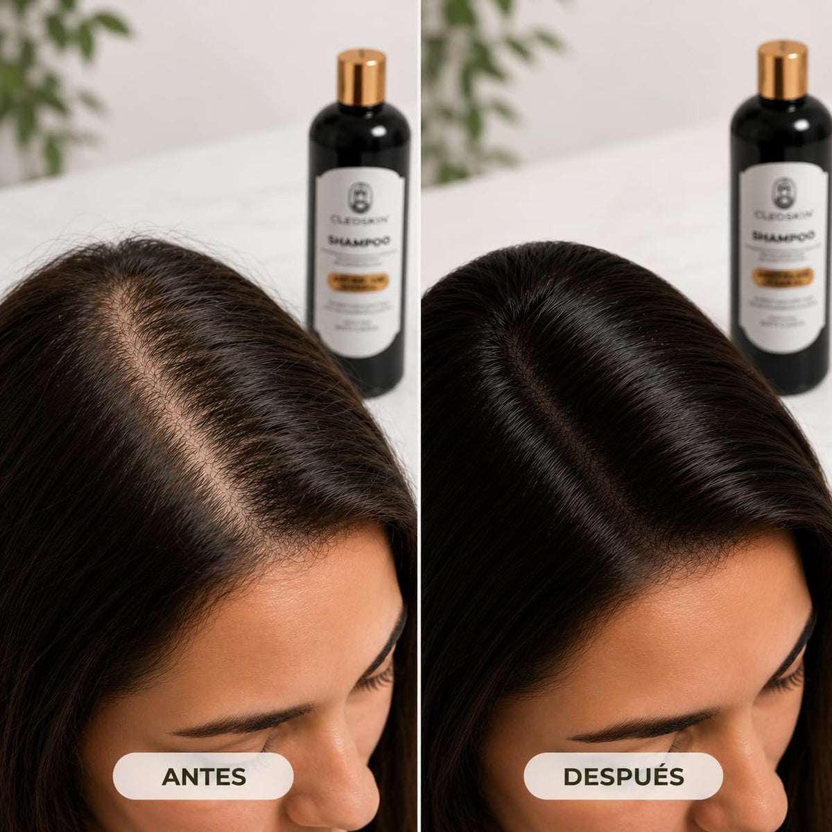 CLEOSKIN Shampoo de Romero para Crecimiento Capilar y Control de Grasa – Tratamiento con Pantenol y Infusión Natural para Fortalecer el Cabello y Aportar Brillo